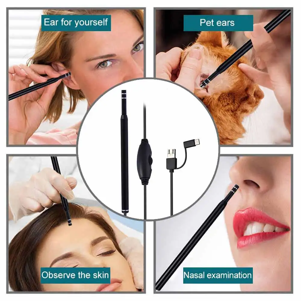 5.5mm 3 In 1 USB Multi-function HD Mini LED Visual Ear Spoon Otoscope Camera Ear Wax Removal Endoscope
5.5mm 3 In 1 USB Multi-function HD Mini LED Visual Ear Spoon Otoscope Camera Ear Wax Removal Endoscope