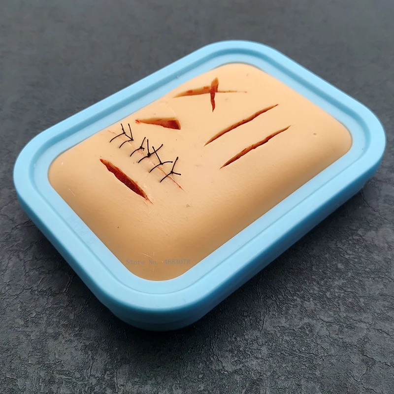 Тренировочный Набор для тренировки наложения швов, модель человеческой травматической кожи, медицинская нить
Тренировочный Набор для тренировки наложения швов, модель человеческой травматической кожи, медицинская нить