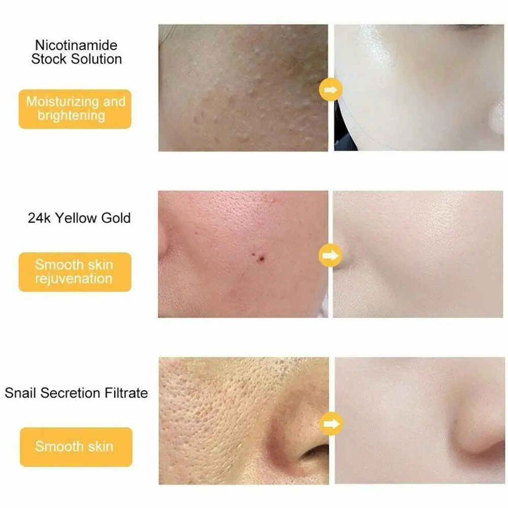 24K Gold Niacinamide Face Essence Moisturizing Anti-Aging Repairs Shrinks Skin & Serum Dry Hyaluronic Pores Loose A A1X1
24K Gold Niacinamide Face Essence Moisturizing Anti-Aging Repairs Shrinks Skin & Serum Dry Hyaluronic Pores Loose A A1X1
