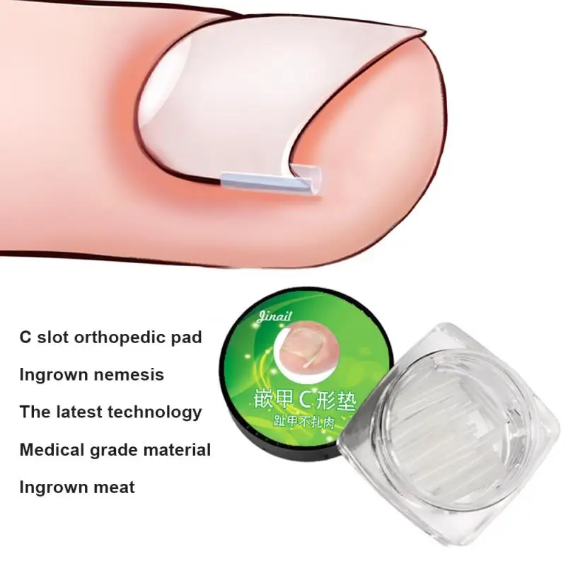 10 Pcs/Box Toe Ingrown Pads Ingrown Valgus Bunion Corrector Orthotics Feet Bone Thumb Adjuster Correction Pedicure Straightener
10 Pcs/Box Toe Ingrown Pads Ingrown Valgus Bunion Corrector Orthotics Feet Bone Thumb Adjuster Correction Pedicure Straightener