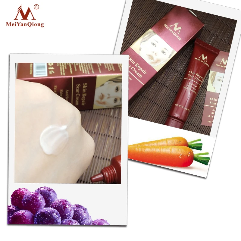 MeiYanQiong Scar Removal Cream Acne Treatment Whitening Cream Remove Stretch Marks Dark Spot Pimples Face Facial Cream Skin Care
MeiYanQiong Scar Removal Cream Acne Treatment Whitening Cream Remove Stretch Marks Dark Spot Pimples Face Facial Cream Skin Care