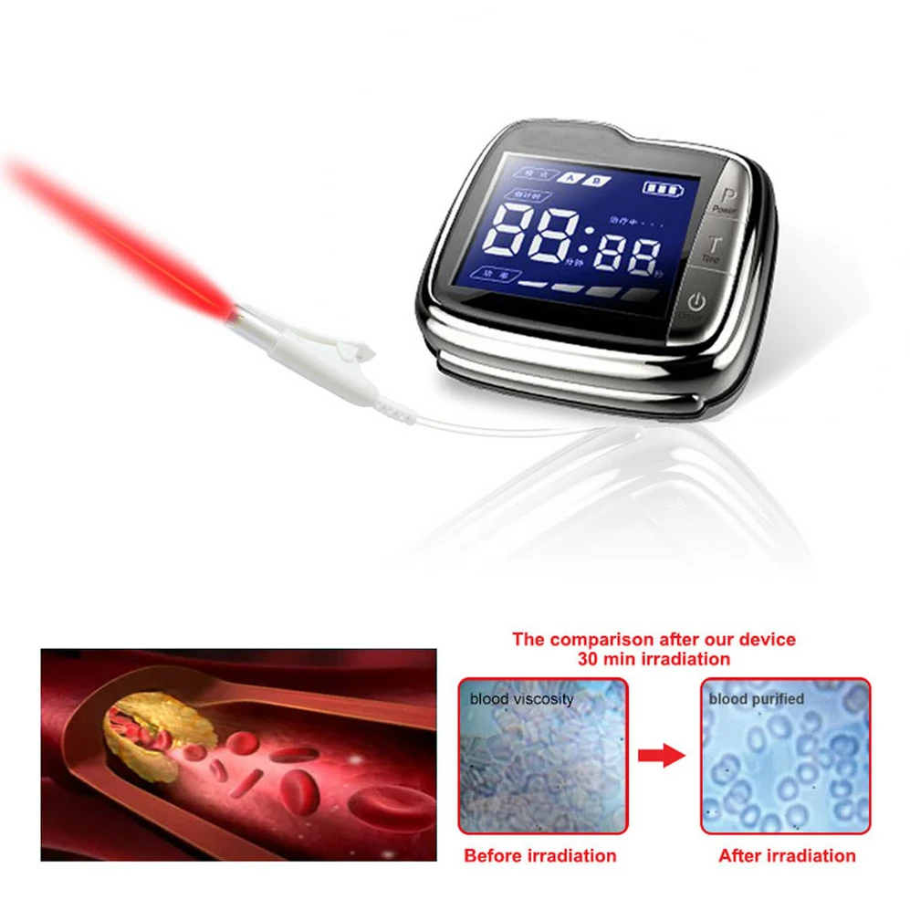 650nm Diode Low Level Laser Therapy Watch LLLT for Diabetes Rhinitis Cholesterol Hypertension Physiotherapy Treatment Healthcare 
650nm Diode Low Level Laser Therapy Watch LLLT for Diabetes Rhinitis Cholesterol Hypertension Physiotherapy Treatment Healthcare