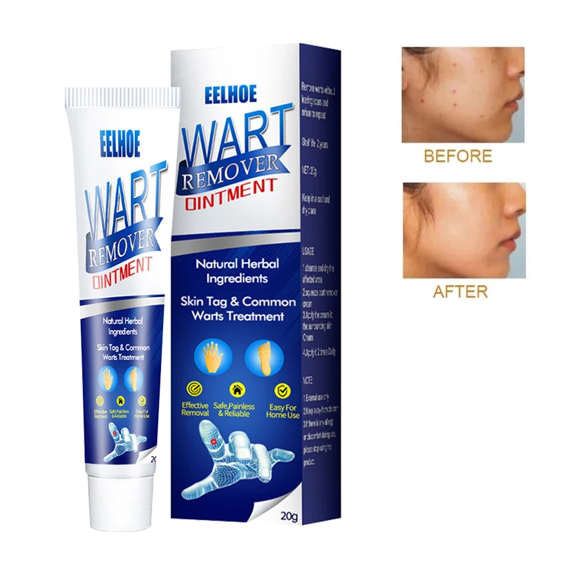 1pcs Warts Remover Ointment Skin Tag Remover Thorn Pain Relief Cream Antibacterial Wart Treatment Herbal Extract Patch
1pcs Warts Remover Ointment Skin Tag Remover Thorn Pain Relief Cream Antibacterial Wart Treatment Herbal Extract Patch
