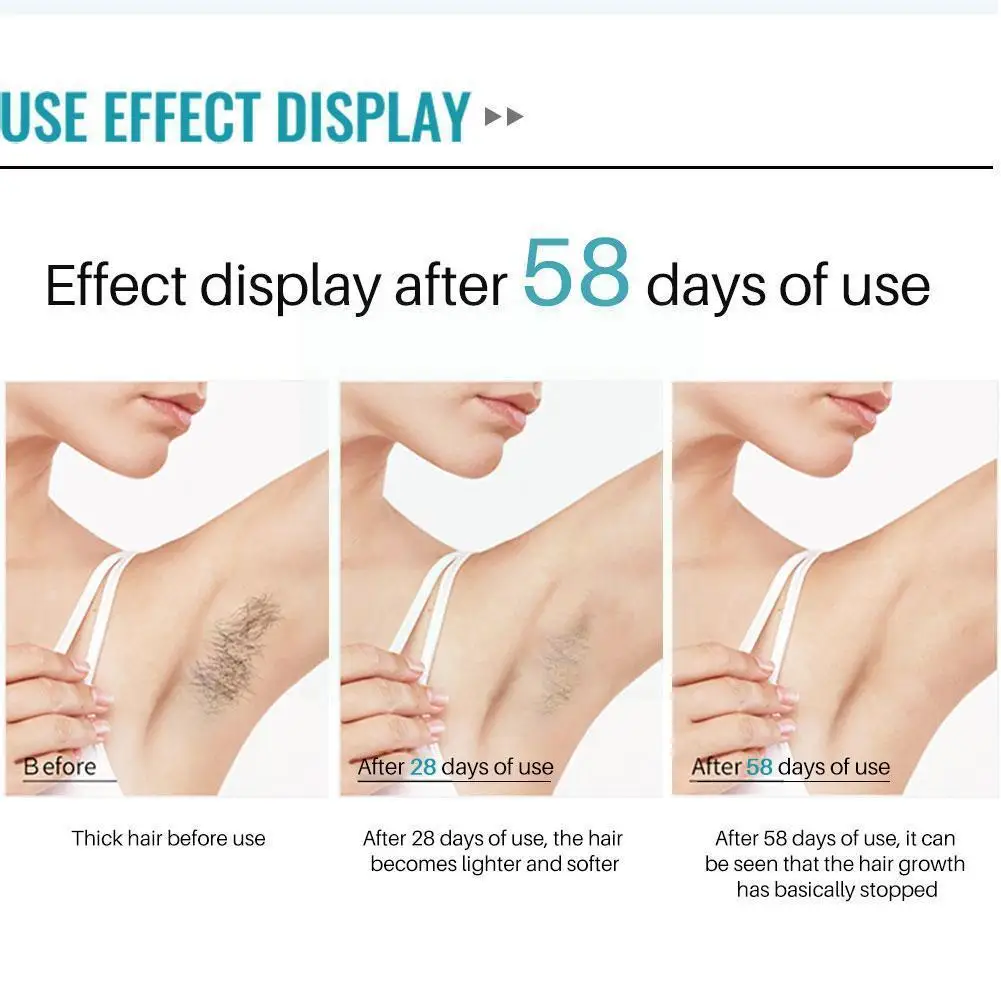 10ml Hair Suppressing Essence Gentle And Non-irritating Bikini Leg Repair Essence Skin And Hair Smooth Armpit Y4I3
10ml Hair Suppressing Essence Gentle And Non-irritating Bikini Leg Repair Essence Skin And Hair Smooth Armpit Y4I3