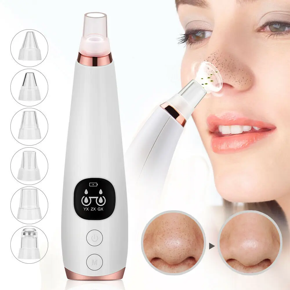 Blackhead Remover Nose T Zone Pore Vacuum Acne Pimple Removal Vacuum Face Suction Tool Facial Diamond Dermabrasion Machine
Blackhead Remover Nose T Zone Pore Vacuum Acne Pimple Removal Vacuum Face Suction Tool Facial Diamond Dermabrasion Machine
