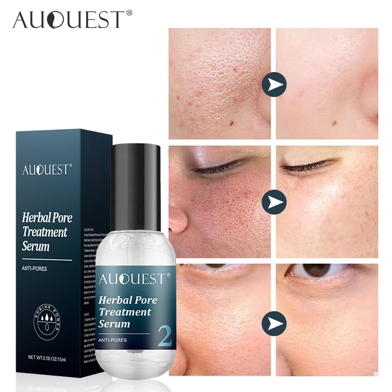 AUQUEST Face Serum Blackhead Removal Pore Shrinking Oil-Control Moisturizing Whitening Skin Face Care Korean Cosmetics 15ml
AUQUEST Face Serum Blackhead Removal Pore Shrinking Oil-Control Moisturizing Whitening Skin Face Care Korean Cosmetics 15ml