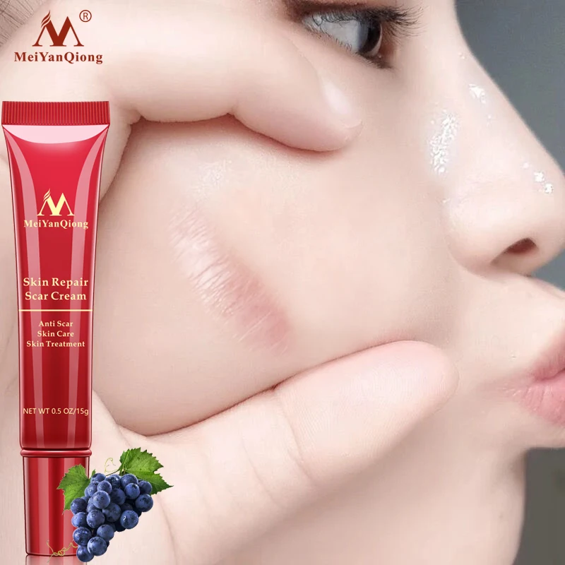 Acne Scar Removal Cream Skin Repair Face Cream Acne Spots Acne Treatment Blackhead Whitening Cream Anti Scar Stretch Marks 15g
Acne Scar Removal Cream Skin Repair Face Cream Acne Spots Acne Treatment Blackhead Whitening Cream Anti Scar Stretch Marks 15g