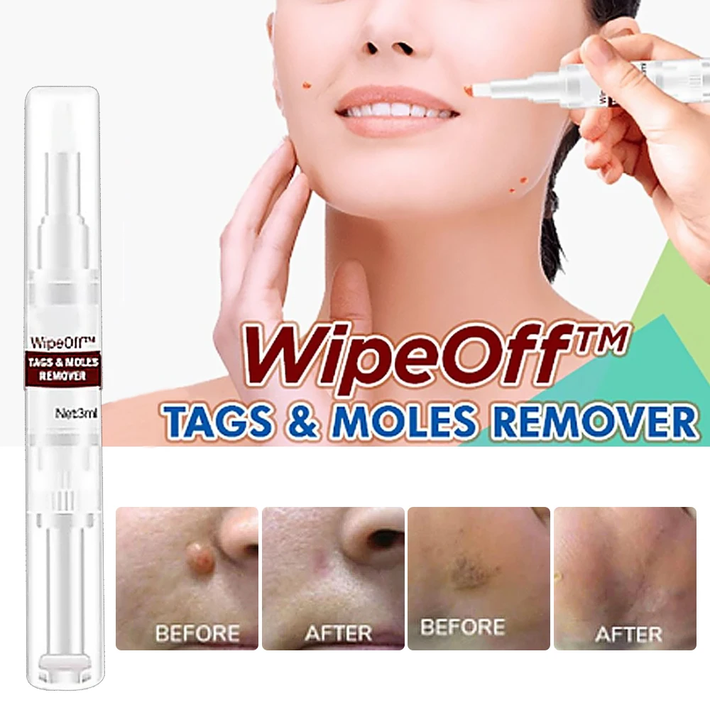 Чистые моли и этикетка, стеклоочиститель, Косметическая ручка для бородавок 3 мл 
Чистые моли и этикетка, стеклоочиститель, Косметическая ручка для бородавок 3 мл