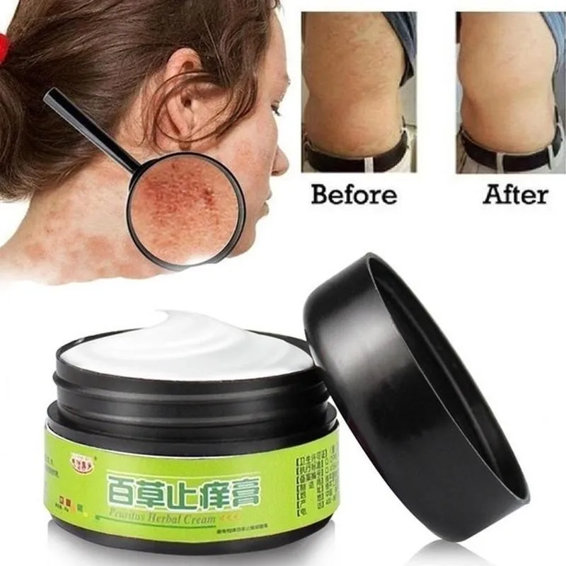 Traditional Herbal Antibacterial Cream Psoriasis Cream Anti-itch Relief Eczema Skin Rash Urticaria Desquamation Treatment
Traditional Herbal Antibacterial Cream Psoriasis Cream Anti-itch Relief Eczema Skin Rash Urticaria Desquamation Treatment