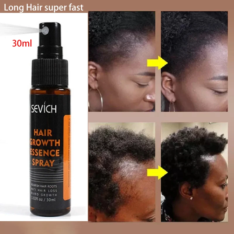 30ml Hair Growth Essence Spray Hair loss Treatment Preventing Hair Loss spray hair Growth Essence Hair Care
30ml Hair Growth Essence Spray Hair loss Treatment Preventing Hair Loss spray hair Growth Essence Hair Care