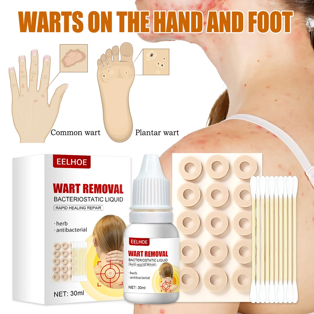 30ml Wart Treatment Liquid Skin Tag Wart Removal Cream Natural Extract Armpit Neck Moles Remover Calluses Corn Removal
30ml Wart Treatment Liquid Skin Tag Wart Removal Cream Natural Extract Armpit Neck Moles Remover Calluses Corn Removal