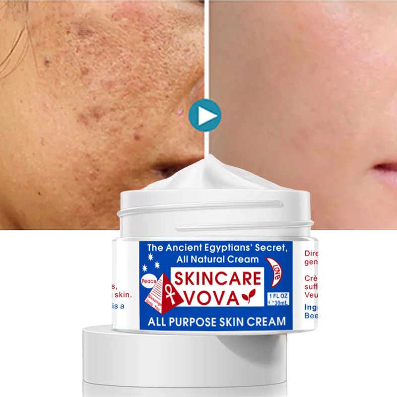 VOVA Newest Firming Eye Cream for Remove Dark Circles Eye Bags Fat Granule Anti-wrinkle Firming Reduces Appearance of Wrinkle
VOVA Newest Firming Eye Cream for Remove Dark Circles Eye Bags Fat Granule Anti-wrinkle Firming Reduces Appearance of Wrinkle