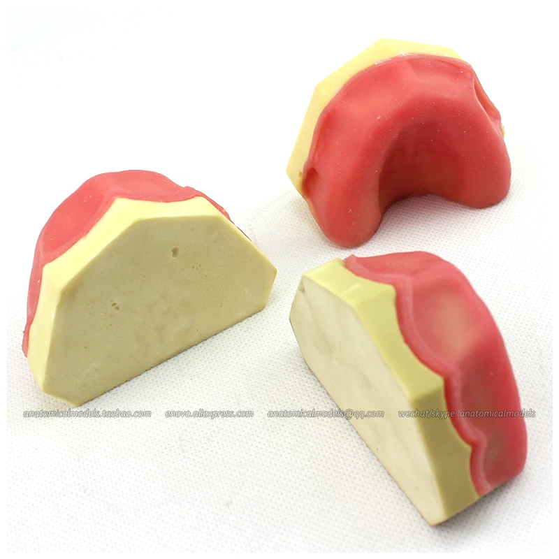 12616 / Implant Practice Edentulous Model, Medical Science Educational Teaching Anatomical Models
12616 / Implant Practice Edentulous Model, Medical Science Educational Teaching Anatomical Models