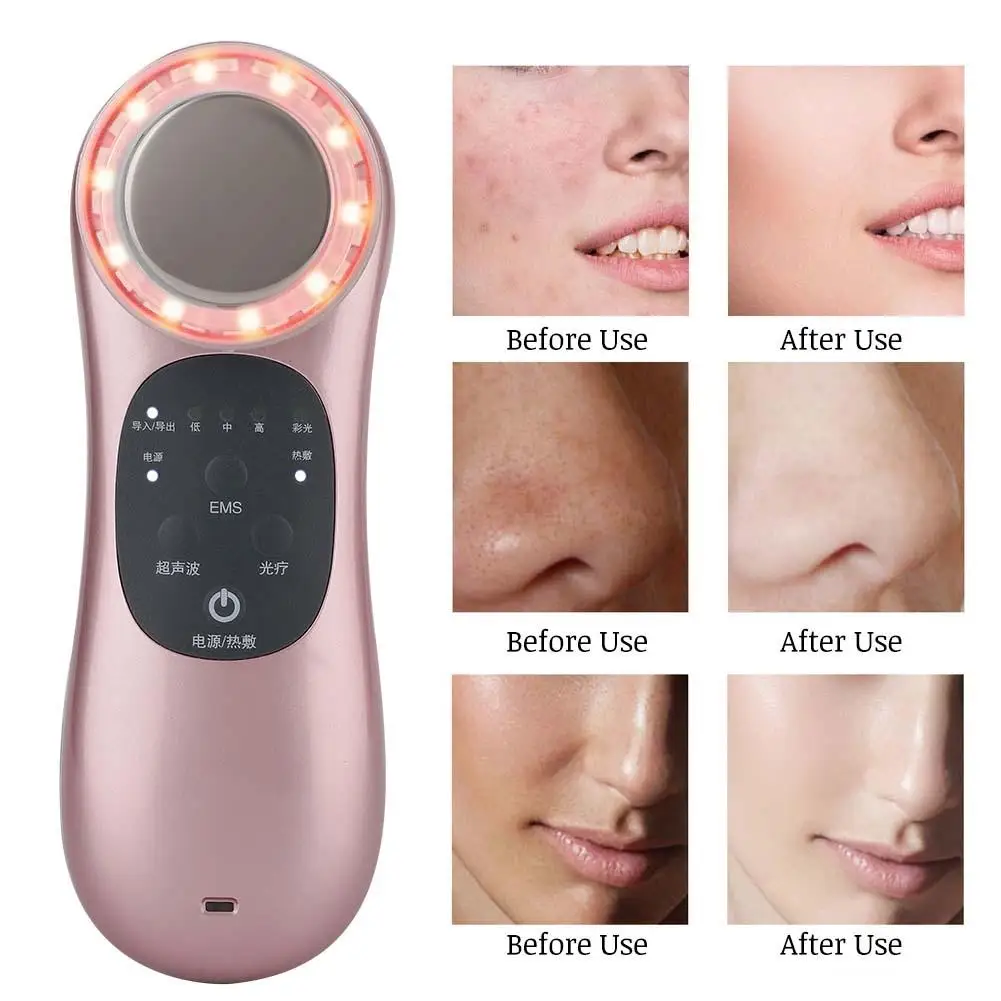 Photon Rejuvenation Lifting Firming Thermoionic Cosmetology Instrumen Skin Renewal Stimulate Blood Circulation Household Massage
Photon Rejuvenation Lifting Firming Thermoionic Cosmetology Instrumen Skin Renewal Stimulate Blood Circulation Household Massage