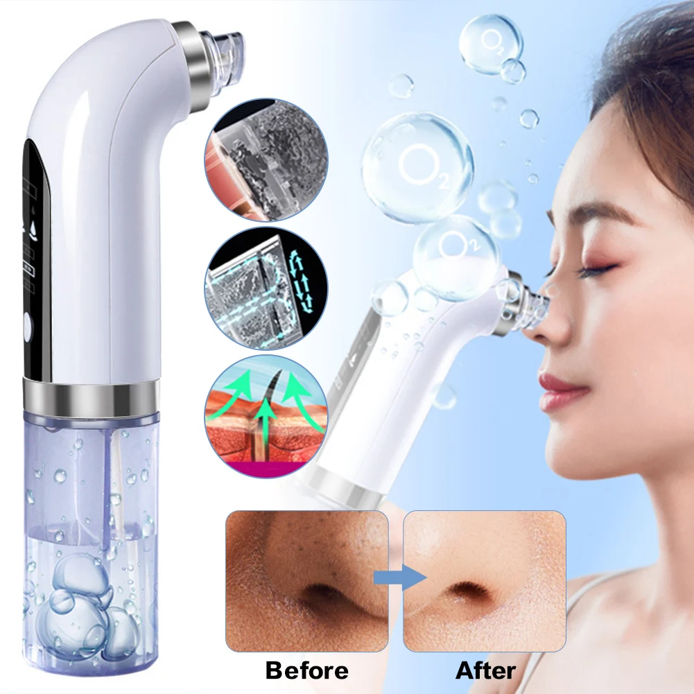 Multifunctional Blackhead Remover Pore Vacuum Cleaner With 3 Suction Modes 6 Replacement Heads Small Bubble Facial Cleaning Tool
Multifunctional Blackhead Remover Pore Vacuum Cleaner With 3 Suction Modes 6 Replacement Heads Small Bubble Facial Cleaning Tool