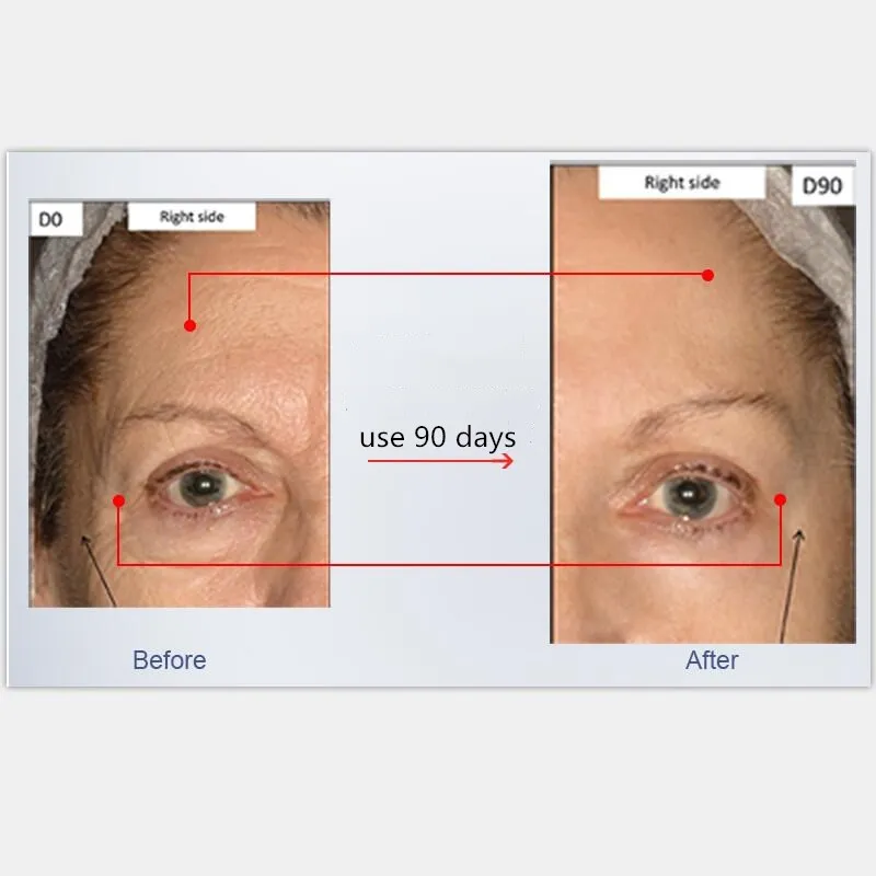 Anti-aging anti-glycation liquid , anti-oxidation, reduce wrinkles, o ral lifting, firming 30 pcs/ box
Anti-aging anti-glycation liquid , anti-oxidation, reduce wrinkles, o ral lifting, firming 30 pcs/ box