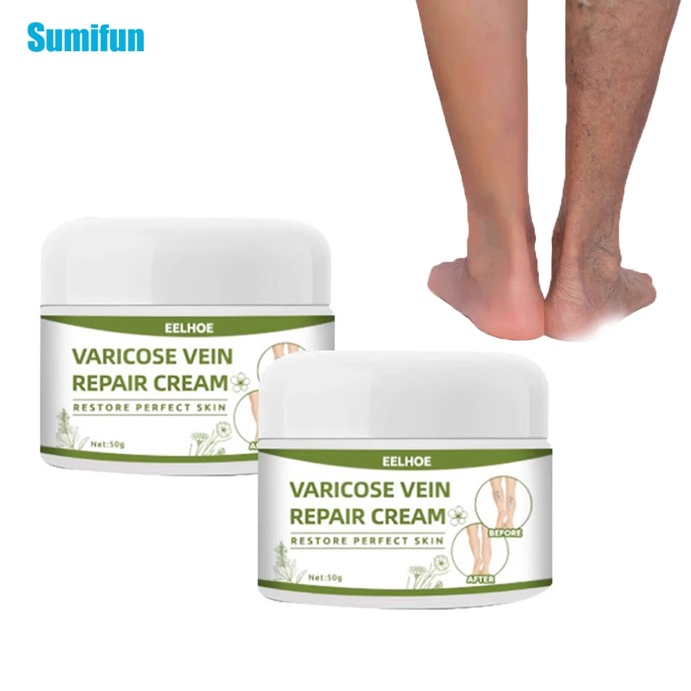 50g Varicose Veins Relief Cream Vasculitis Phlebitis Spider Pain Relief Ointment Vasculitis Phlebitis Spider Medical Plaster
50g Varicose Veins Relief Cream Vasculitis Phlebitis Spider Pain Relief Ointment Vasculitis Phlebitis Spider Medical Plaster