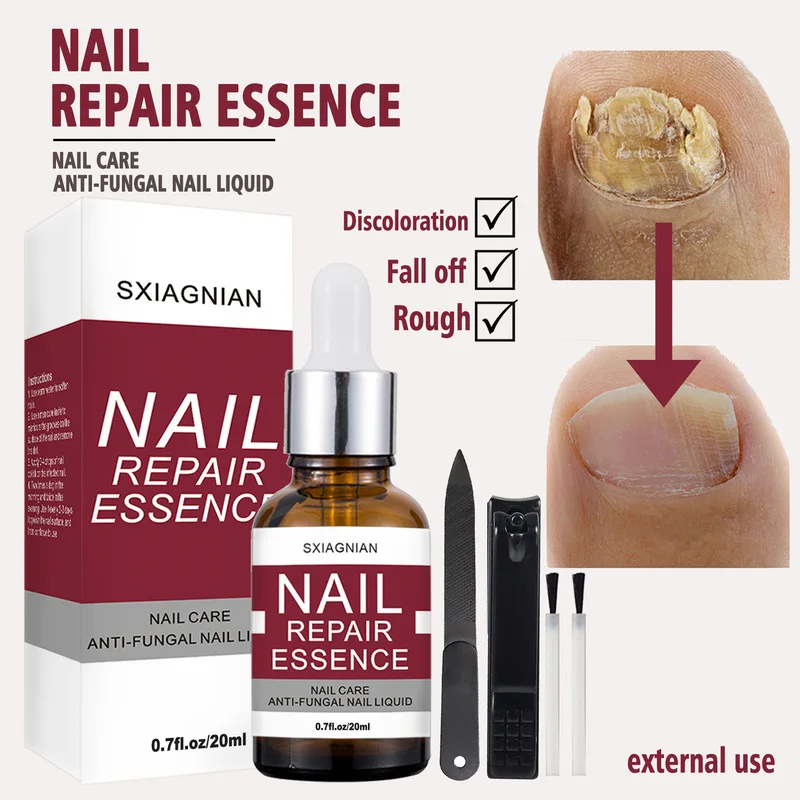 SXIAGNIAN Fungal Nail Repair Essence Serum Treatment Foot Care Nail Fungus Removal Gel Anti Infection Paronychia Onychomycosis
SXIAGNIAN Fungal Nail Repair Essence Serum Treatment Foot Care Nail Fungus Removal Gel Anti Infection Paronychia Onychomycosis