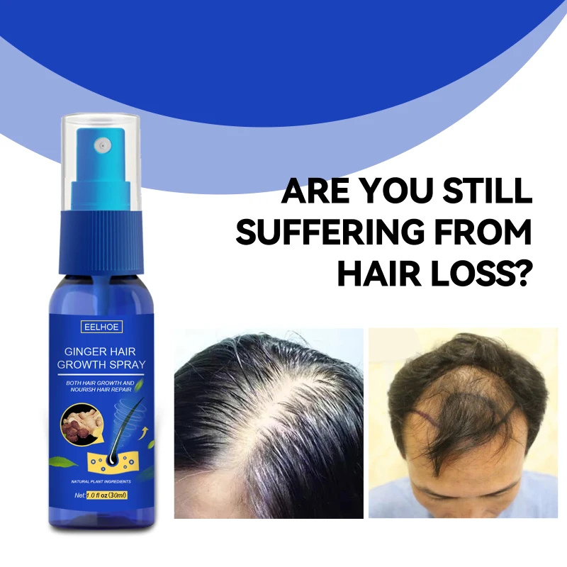 Eelhoe Ginger Hair Growth Spray Fast Grow Hair Loss Preventing Hair Loss Care Dense Beauty Hair Growth Spray For Man Cosmetics
Eelhoe Ginger Hair Growth Spray Fast Grow Hair Loss Preventing Hair Loss Care Dense Beauty Hair Growth Spray For Man Cosmetics