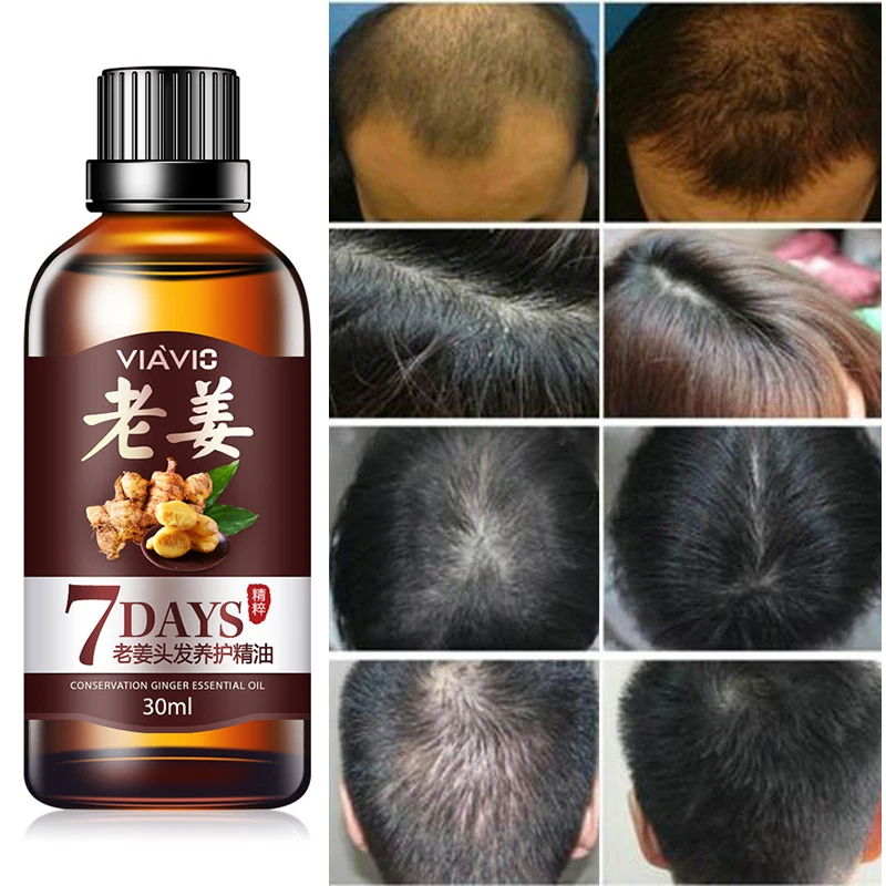 30ML Effective Hair Growth Ointment Hair Care Healthy Ginger Hair Care Growth Essence Oil Hair Loss Protection Essence Bin TSLM1
30ML Effective Hair Growth Ointment Hair Care Healthy Ginger Hair Care Growth Essence Oil Hair Loss Protection Essence Bin TSLM1
