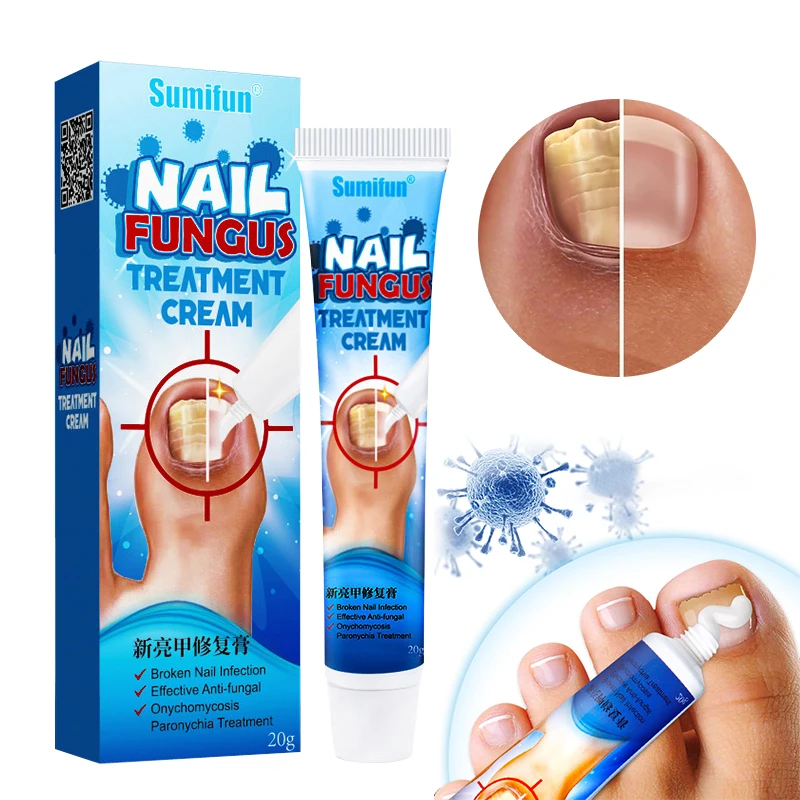 1Pcs Nail Fungus Removal Cream Onychomycosis Fungal Nail Treatment Paronychia Anti Infection Feet Toe Fungal Nail Care Ointment
1Pcs Nail Fungus Removal Cream Onychomycosis Fungal Nail Treatment Paronychia Anti Infection Feet Toe Fungal Nail Care Ointment
