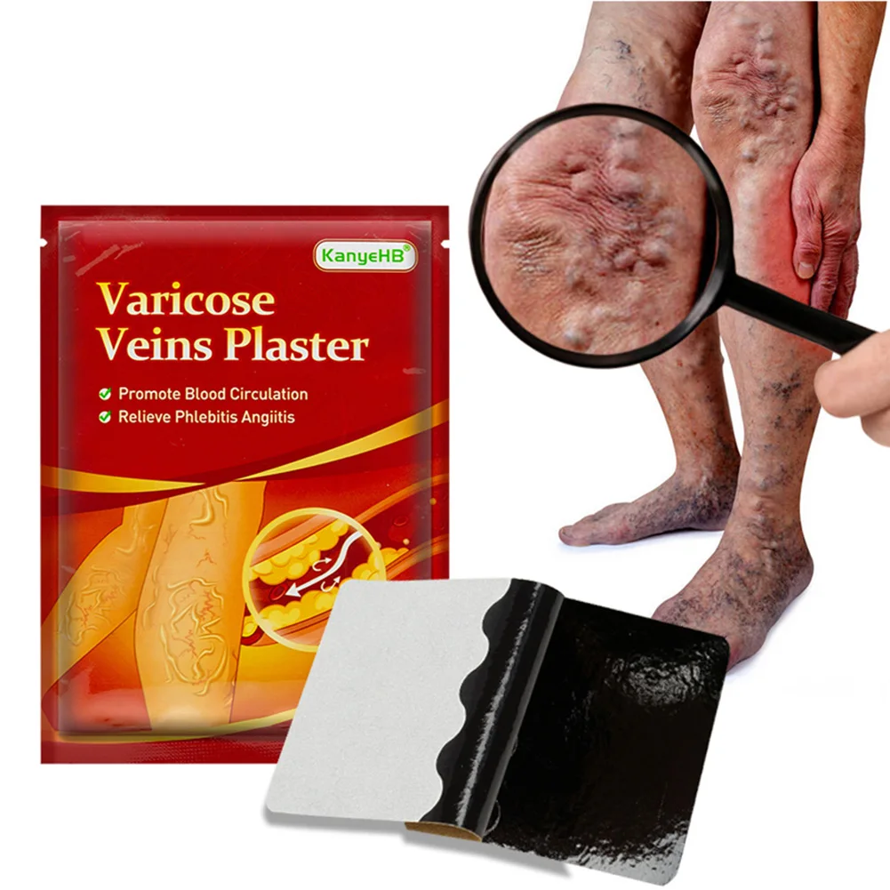 6/12/24pcs Varicose Veins Ointmnet Vasculitis Phlebitis Spider Cream Varicosity Angiitis Removal Herbal Medical Plaster
6/12/24pcs Varicose Veins Ointmnet Vasculitis Phlebitis Spider Cream Varicosity Angiitis Removal Herbal Medical Plaster