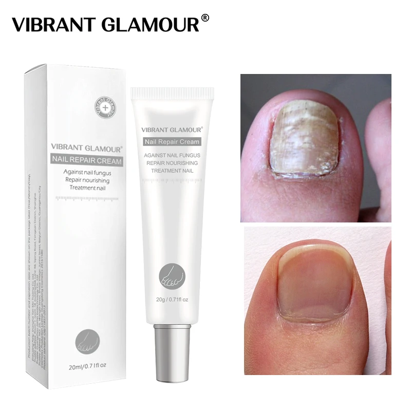 VIBRANT GLAMOUR Nail Repair Cream Nail Anti-fungal Treatment Onychomycosis Removal Nourishing Smooth Naill Hand Feet Care 20ml
VIBRANT GLAMOUR Nail Repair Cream Nail Anti-fungal Treatment Onychomycosis Removal Nourishing Smooth Naill Hand Feet Care 20ml