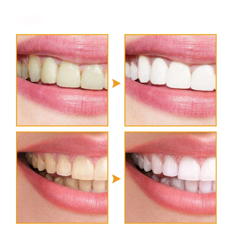 Tooth Pen Oral Stain Removal Yellow Teeth Rotary Type Teeth Whitening Pen To Clean and Powerfully Remove Yellow Teeth Tooth Pen
Tooth Pen Oral Stain Removal Yellow Teeth Rotary Type Teeth Whitening Pen To Clean and Powerfully Remove Yellow Teeth Tooth Pen