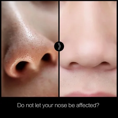 Bamboo Charcoal Black Mask Peel Off Nose Blackhead Dead Skin Clean Blackhead Pores Shrink Face Care Tool
Bamboo Charcoal Black Mask Peel Off Nose Blackhead Dead Skin Clean Blackhead Pores Shrink Face Care Tool