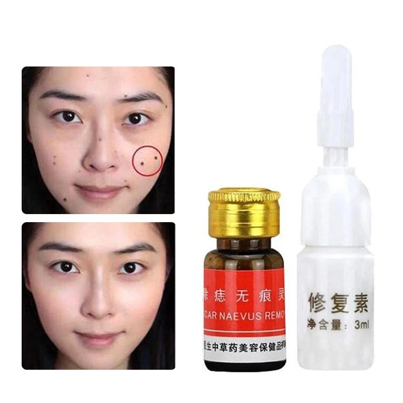 2Pcs Mole Skin Water Tag Remover Serum Mole Removal Cream Face Care Repair Solution Removal Solution Removal Cream Oil Plaster
2Pcs Mole Skin Water Tag Remover Serum Mole Removal Cream Face Care Repair Solution Removal Solution Removal Cream Oil Plaster