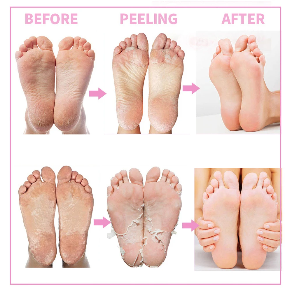 1 Pair Of 35g Rose Foot Peel Mask Improve Dry Rough Crack Remove Hardened Skin Deep Moisturizing Skin Care 
1 Pair Of 35g Rose Foot Peel Mask Improve Dry Rough Crack Remove Hardened Skin Deep Moisturizing Skin Care