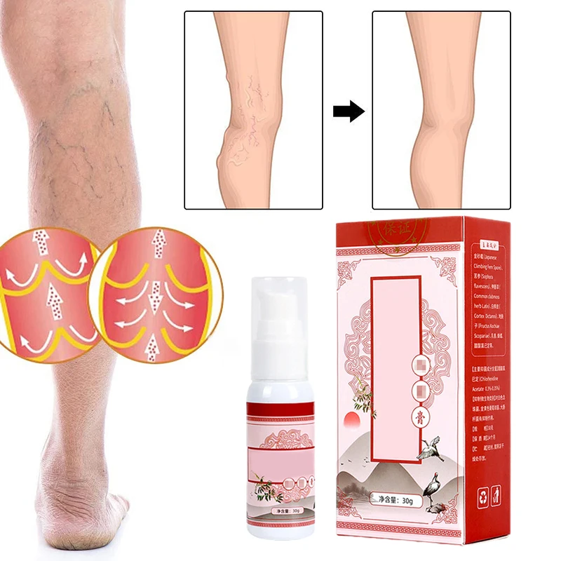 Varicose Veins Cream Relief Phlebitis Angiitis Remedy Pain Relief Cream for Spider Veins Edema Nerve Pain Leg Pain AC
Varicose Veins Cream Relief Phlebitis Angiitis Remedy Pain Relief Cream for Spider Veins Edema Nerve Pain Leg Pain AC