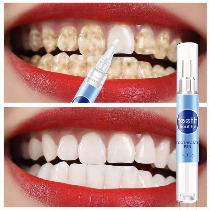 Teeth Whitening Pen Oral Hygiene Care Cleaning Serum Remove Plaque Stains Dental Bleach Tools Whiten Tooth Whitening Instrument
Teeth Whitening Pen Oral Hygiene Care Cleaning Serum Remove Plaque Stains Dental Bleach Tools Whiten Tooth Whitening Instrument