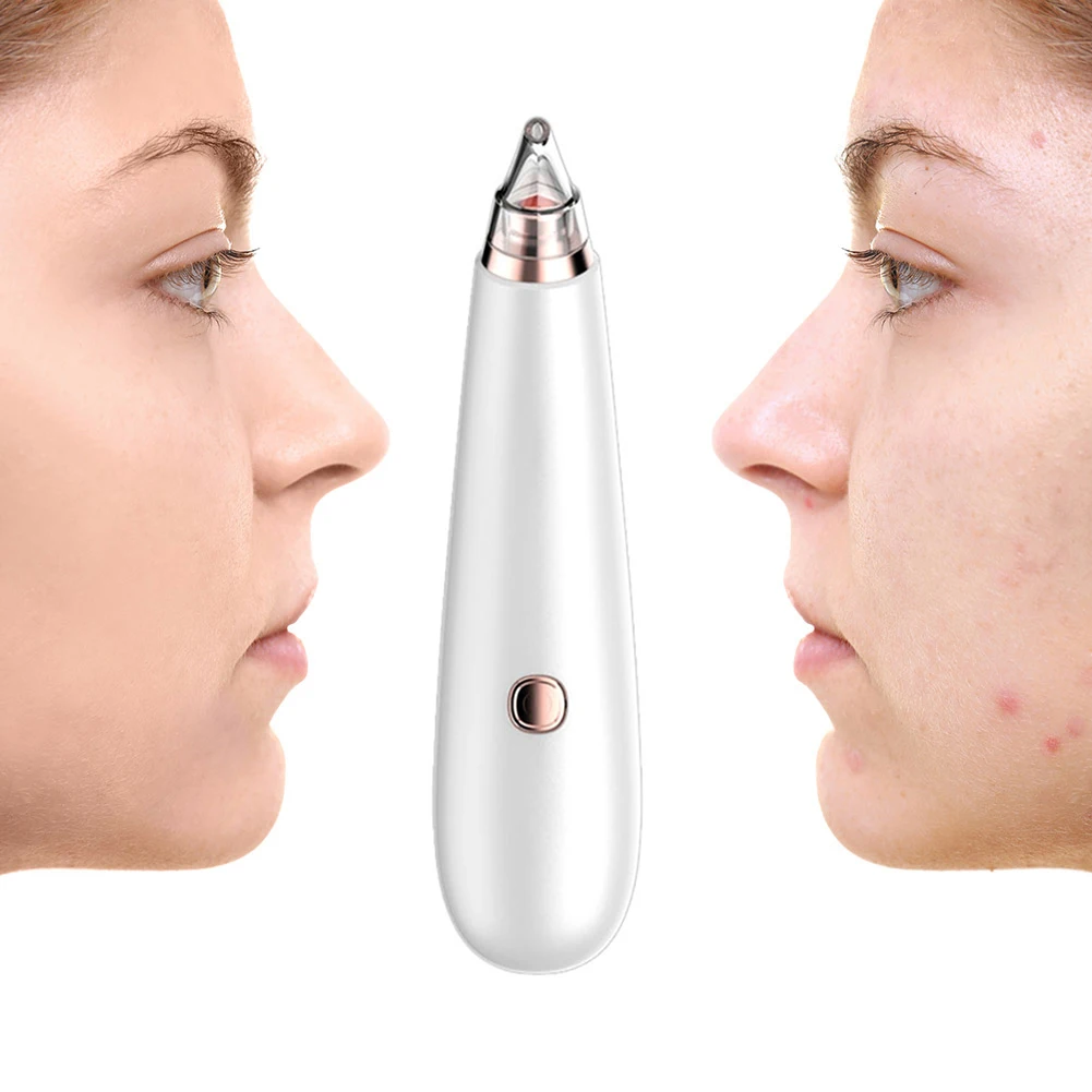 Nose Pore Acne Pimple Removal Cleaner Facial Skin Blackhead Remover Extractor Clean Exfoliating Instrument Spot Cleaner
Nose Pore Acne Pimple Removal Cleaner Facial Skin Blackhead Remover Extractor Clean Exfoliating Instrument Spot Cleaner