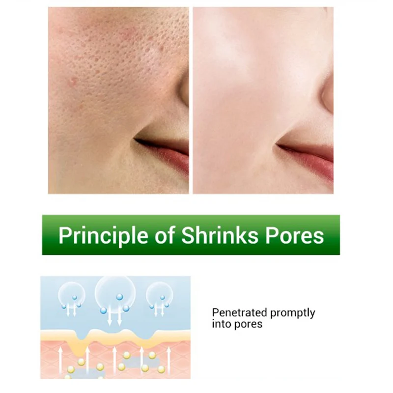 Shrink Pores Serum Pore Tightens Refining Moisturizing Essence 
Shrink Pores Serum Pore Tightens Refining Moisturizing Essence