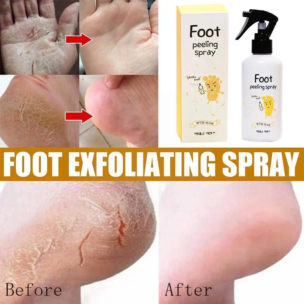 Foot Peeling Spray Natural Orange Essence Dead Skin Care Moisturizer Calluses Whiten Moisturizing Remover Spray Cosmetic Fo G2m4
Foot Peeling Spray Natural Orange Essence Dead Skin Care Moisturizer Calluses Whiten Moisturizing Remover Spray Cosmetic Fo G2m4
