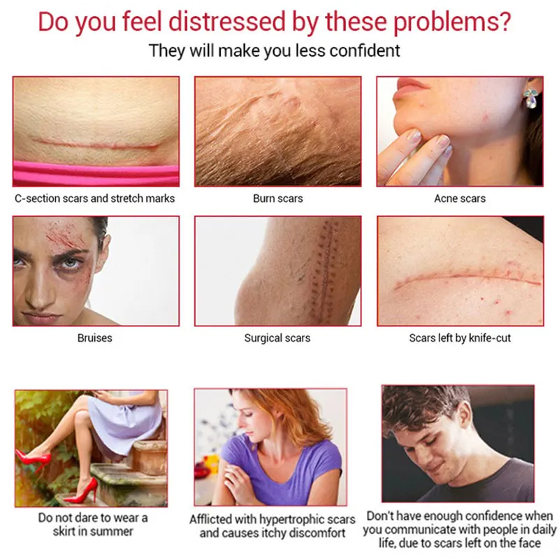 LANBENA Acne Scar Treatment Sets Skin Repair Cream Scar Stretch Remove Serum Whitening Deep Moisturizing Essence Skin Care Set 
LANBENA Acne Scar Treatment Sets Skin Repair Cream Scar Stretch Remove Serum Whitening Deep Moisturizing Essence Skin Care Set