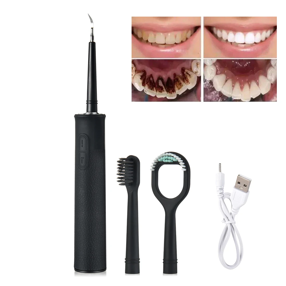 Электрический звуковой инструмент для удаления зубного камня, стоматолог, отбеливатель от зубных пятен, щетка для покрытия языка зубная ще...
Электрический звуковой инструмент для удаления зубного камня, стоматолог, отбеливатель от зубных пятен, щетка для покрытия языка зубная ще...