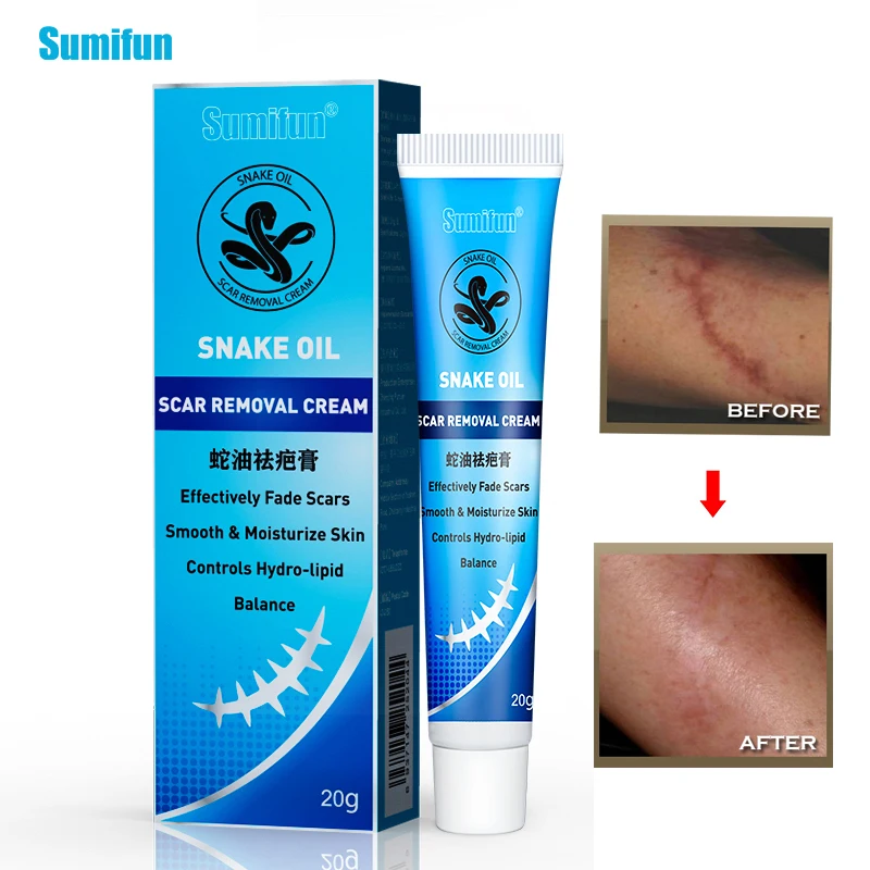 New Sumifun 3Pcs Snake Oil Ointment Remove Scar Cream Acne Treatment Hand Skin Face Care Natural Traditional Chinese Medicine
New Sumifun 3Pcs Snake Oil Ointment Remove Scar Cream Acne Treatment Hand Skin Face Care Natural Traditional Chinese Medicine