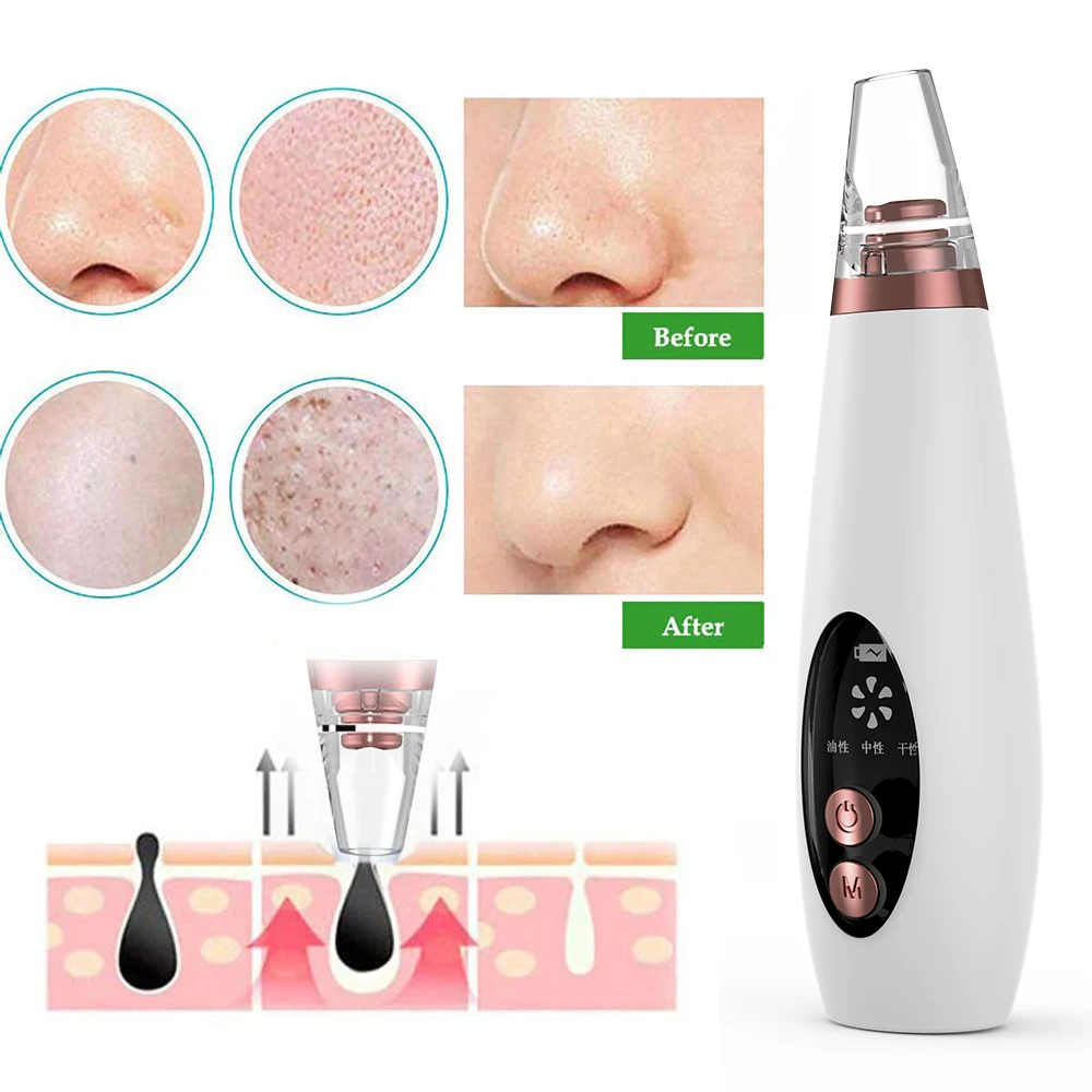 Pore Vacuum Suction Blackhead Remover USB Face Deep Nose Cleaner T Zone Pore Acne Pimple Removal Facial Beauty Clean Skin Tool
Pore Vacuum Suction Blackhead Remover USB Face Deep Nose Cleaner T Zone Pore Acne Pimple Removal Facial Beauty Clean Skin Tool