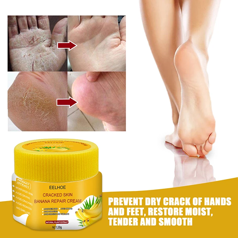 20g Anti Crack Foot Cream Banana Oil Anti-Drying Foot Mask Heel Cracked Repair Cream Removal Dead Skin Hand Feet Care Moisturiz
20g Anti Crack Foot Cream Banana Oil Anti-Drying Foot Mask Heel Cracked Repair Cream Removal Dead Skin Hand Feet Care Moisturiz
