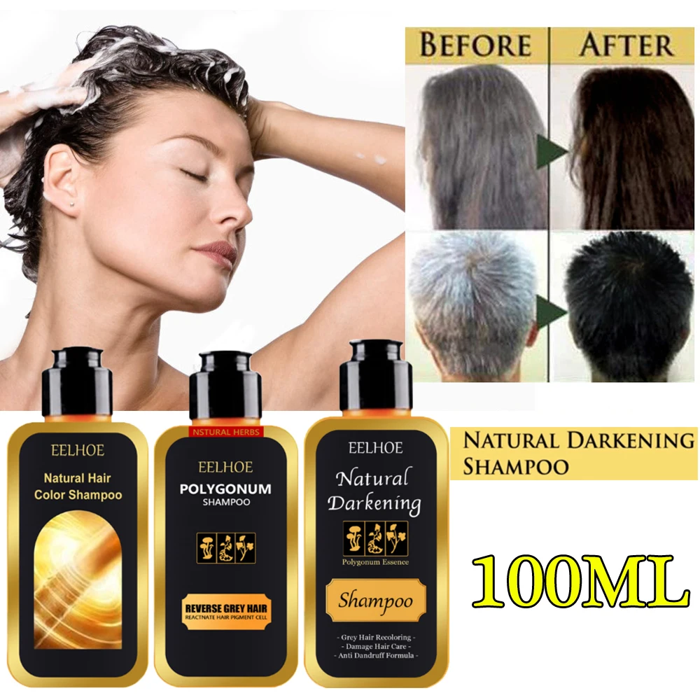 Ginger Hair Shampoo Growth Dense Regrowth Serum Anti Hair Loss Oil Natural Extract Treatment Essence Soften Darkening Unisex
Ginger Hair Shampoo Growth Dense Regrowth Serum Anti Hair Loss Oil Natural Extract Treatment Essence Soften Darkening Unisex