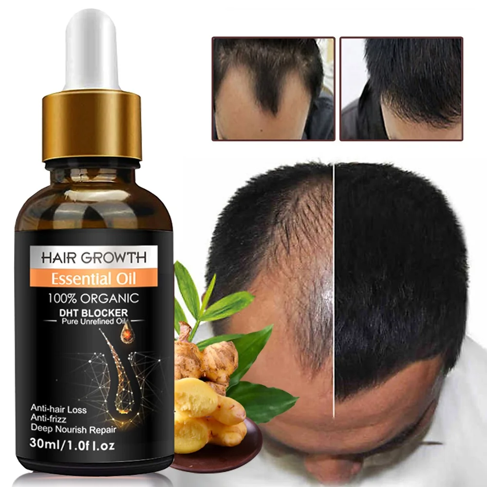 Ginger Hair Growth Essential Oils Anti Hair Loss Essence Hair Growth Products Fast Germinal Liquid Repair Nourishing Hair Care
Ginger Hair Growth Essential Oils Anti Hair Loss Essence Hair Growth Products Fast Germinal Liquid Repair Nourishing Hair Care
