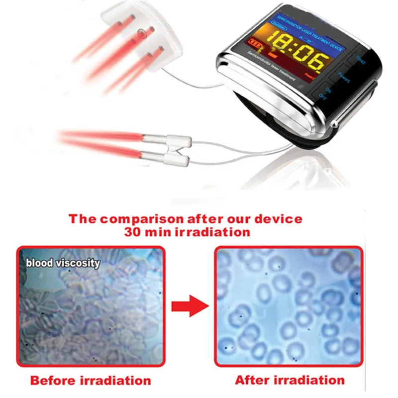 Laser Therapy Watch Cure Rhinitis Hypertension Diabetes Prevent Arteriosclerosis 
Laser Therapy Watch Cure Rhinitis Hypertension Diabetes Prevent Arteriosclerosis