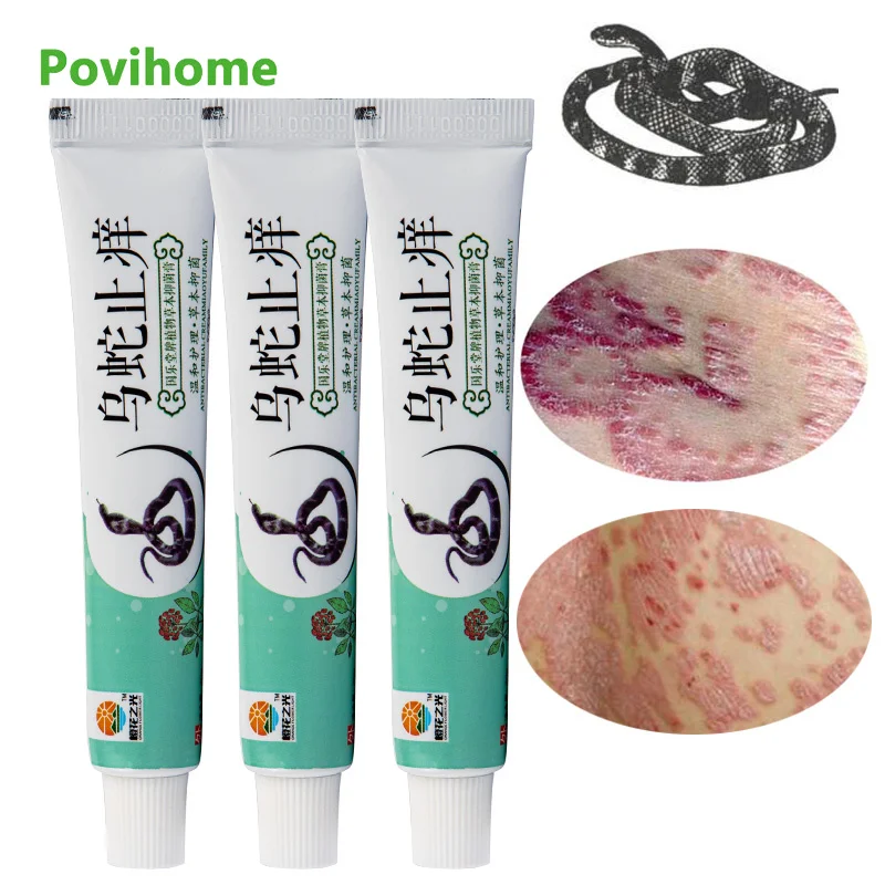 1/3pcs 20g Snake Venom Ointment Antibacterial Cream Eczema Psoriasis Cream Anti-itch Relief Skin Rash Urticaria Desquamation
1/3pcs 20g Snake Venom Ointment Antibacterial Cream Eczema Psoriasis Cream Anti-itch Relief Skin Rash Urticaria Desquamation