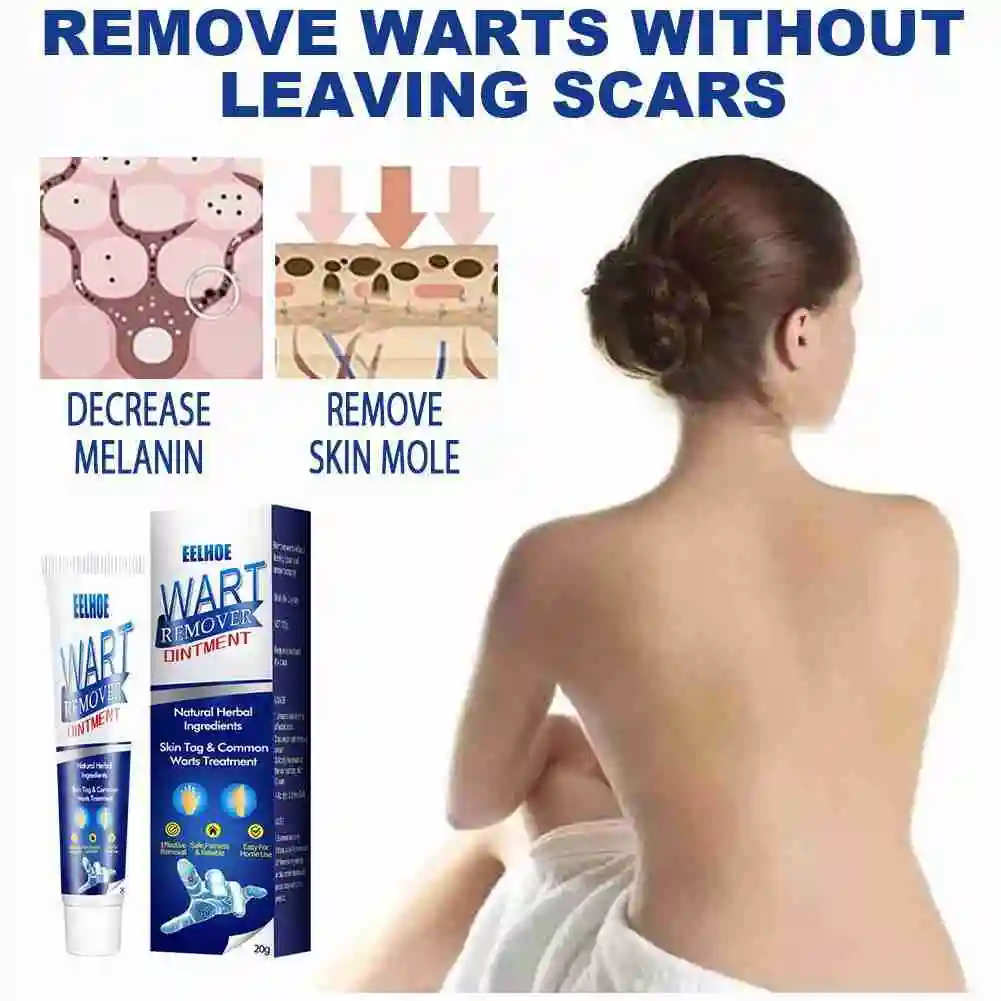 Instant Blemish Removal Gel Wart Removal Body Warts Treatment Cream Foot Care Cream Skin Tag Wart Remover Cream 20g
Instant Blemish Removal Gel Wart Removal Body Warts Treatment Cream Foot Care Cream Skin Tag Wart Remover Cream 20g