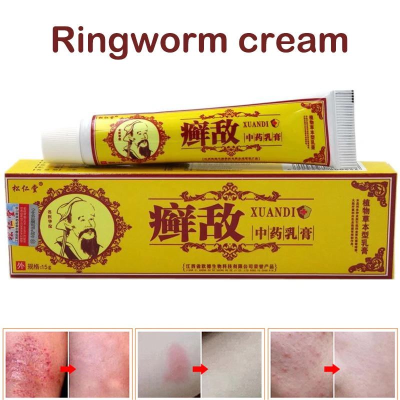 Псориаз экзема крем Антибактериальный зуд крем для тела Прямая поставка -- 01 
Псориаз экзема крем Антибактериальный зуд крем для тела Прямая поставка -- 01