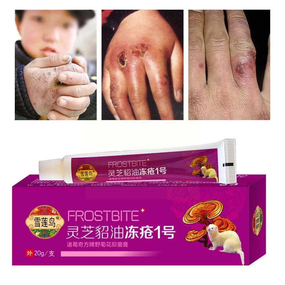 Snowy Ice Frostbite Ointment Moisturizing Moisturizing Dry Repairing Anti-Freezing Supplies Anti-Cracking Anti-Cracking Z5I7
Snowy Ice Frostbite Ointment Moisturizing Moisturizing Dry Repairing Anti-Freezing Supplies Anti-Cracking Anti-Cracking Z5I7