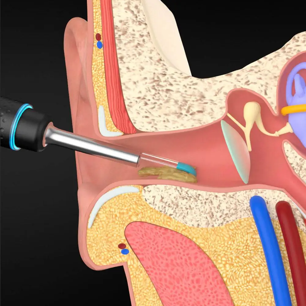 Xiaomi Bebird M9 Pro Smart Visual Ear-Stick Endoscope 300W High Precision In-Ear Endoscope With 300mAh Magnetically Charged Base
Xiaomi Bebird M9 Pro Smart Visual Ear-Stick Endoscope 300W High Precision In-Ear Endoscope With 300mAh Magnetically Charged Base