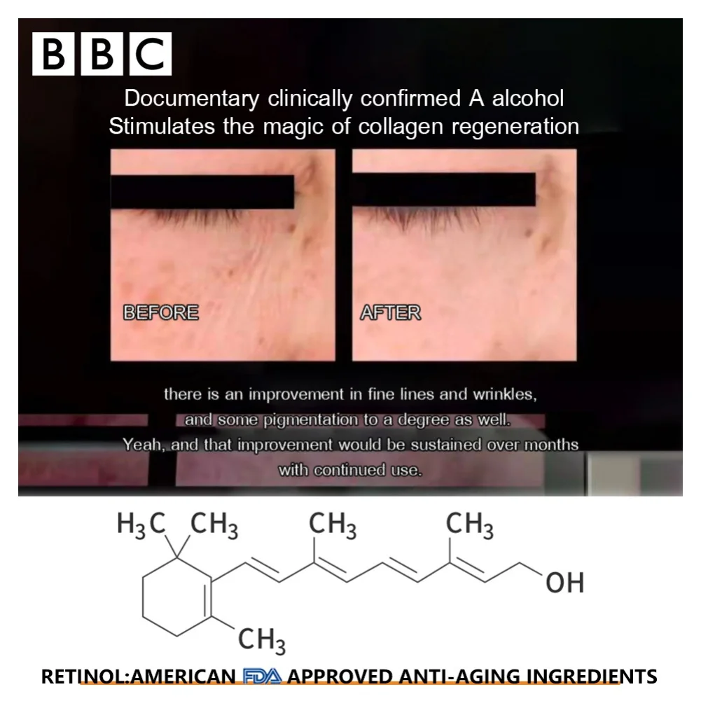 Retinol Eye Cream Removes Dark Circles Reduces Fine Lines Brightens Skin Moisturizing Arbutin Eye Cream
Retinol Eye Cream Removes Dark Circles Reduces Fine Lines Brightens Skin Moisturizing Arbutin Eye Cream